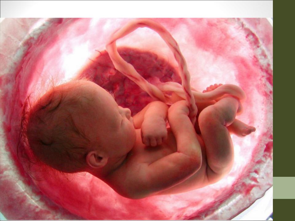 У Польщі вагітна жінка загинула через заборону абортів