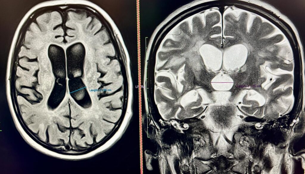 У Львові медики врятували 40-річну жінку